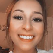 Yoyo Hyderabad escort